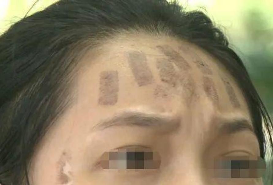 成都光子嫩膚價格，科技重塑肌膚之美